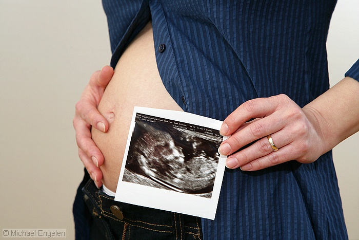 images/pregnant1_std.jpg